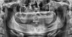 1904rdhbur P02 1904rdhbur P02