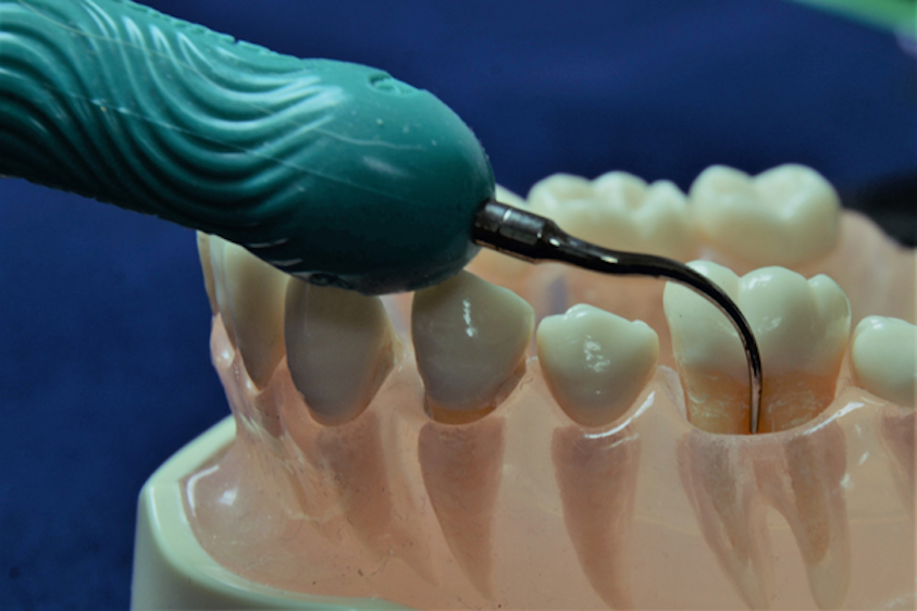 Ultrasonic instrumentation in the dental hygiene curricula Are we