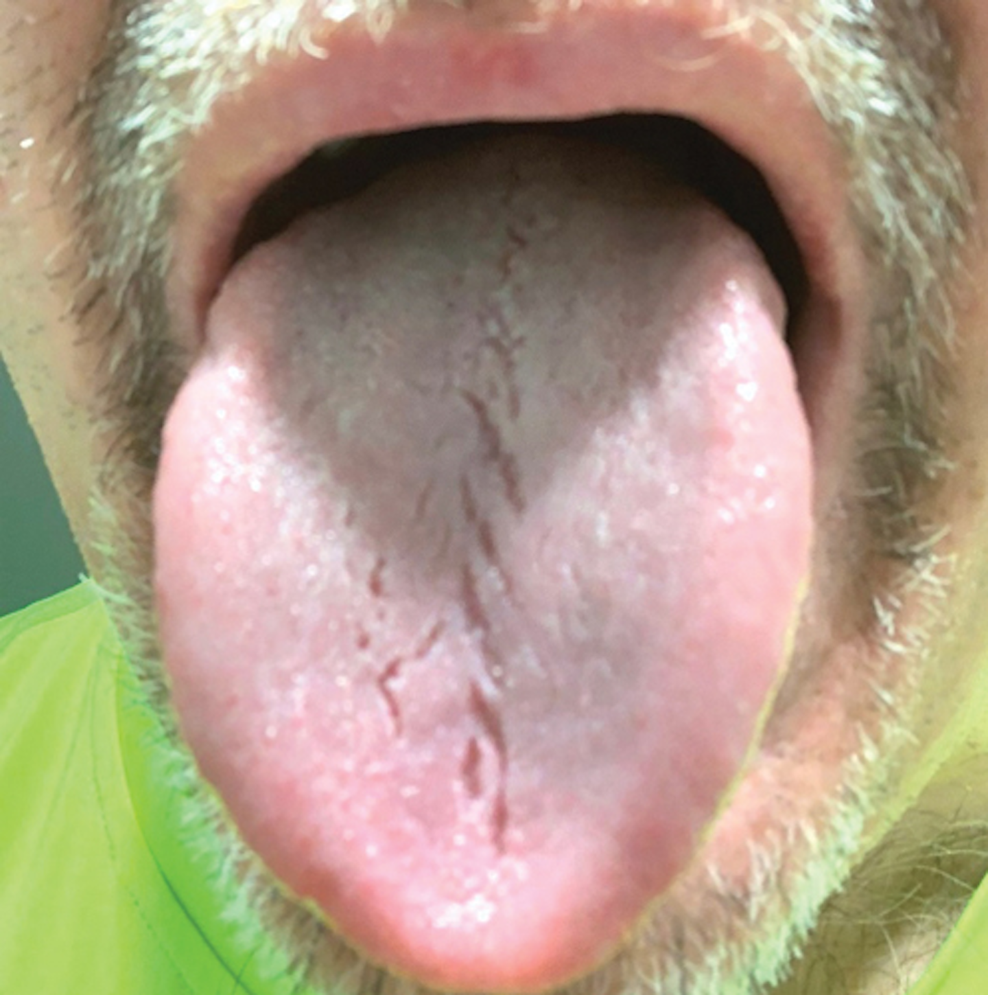 The Neglected Duty Registered Dental Hygienist Rdh Magazine