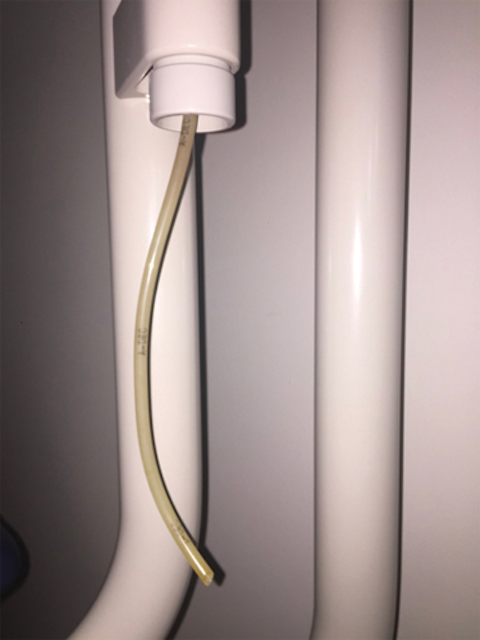 Figure 4: Example of dental unit water bottle. Note how the tubing is left open to atmospheric contamination if a new bottle is not immediately replaced.
