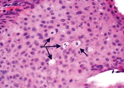 1905rdhbur P02 1905rdhbur P02