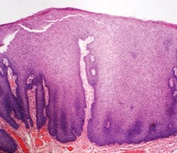 1905rdhbur P03 1905rdhbur P03