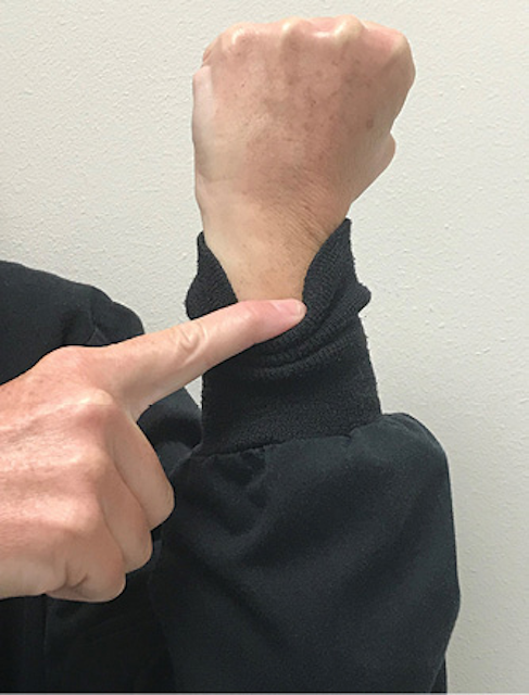 Figure 4: Pull the lab coat’s cuff below the wrist to illustrate gum recession.