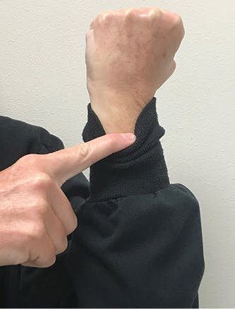 Figure 4: Pull the lab coat&rsquo;s cuff below the wrist to illustrate gum recession.