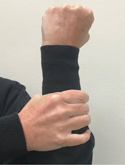 Figure 6: Lower the grasp on the arm and wiggle the arm to show how movement increases as bone height decreases around the root. Figure 6: Lower the grasp on the arm and wiggle the arm to show how movement increases as bone height decreases around the root.