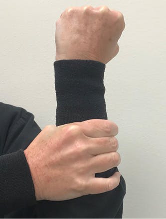 Figure 6: Lower the grasp on the arm and wiggle the arm to show how movement increases as bone height decreases around the root.
