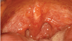 1906 Rd Hbur P01 5d2508efc4bc3 1906 Rd Hbur P01 5d2508efc4bc3