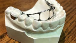 Figure 1: An example of a palatal crib Figure 1: An example of a palatal crib