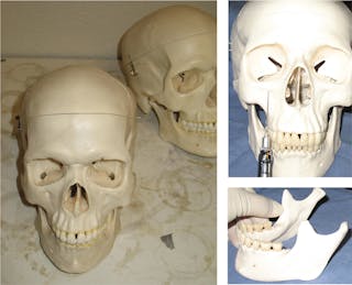 Figure 2: Three-piece skull models (left); skull model with syringe/needle positioning (upper right); mandible removed from skull model (lower right)