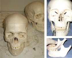 Figure 2: Three-piece skull models (left); skull model with syringe/needle positioning (upper right); mandible removed from skull model (lower right) Figure 2: Three-piece skull models (left); skull model with syringe/needle positioning (upper right); mandible removed from skull model (lower right)