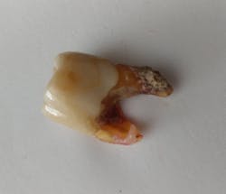 1909 Rd Hwat P03 5d7b144d161c9 1909 Rd Hwat P03 5d7b144d161c9