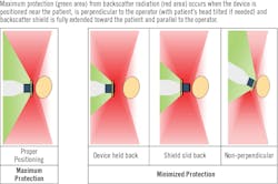 Figure 1: Example of manufacturer instructions on achieving maximum protection from x-rays through proper positioning of the handheld device Figure 1: Example of manufacturer instructions on achieving maximum protection from x-rays through proper positioning of the handheld device