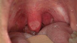 1910 Rd Hbur Thumb 2 5dc5afe6c51d3 1910 Rd Hbur Thumb 2 5dc5afe6c51d3