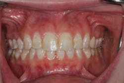 Figure 1: Patient presentation Figure 1: Patient presentation