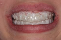 Figure 5: Application of Remin Pro Figure 5: Application of Remin Pro