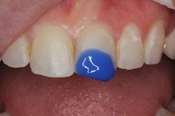 Figure 7: Completion of treatment Figure 7: Completion of treatment