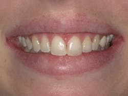 Figure 8: Five years post treatment Figure 8: Five years post treatment