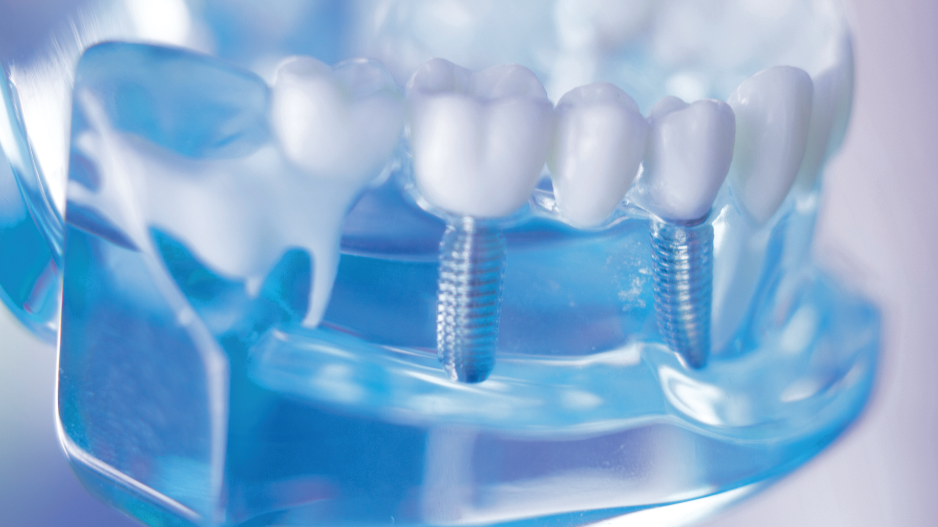 1910 Rd Hrho P12 16x9 5dd578c0d4e13