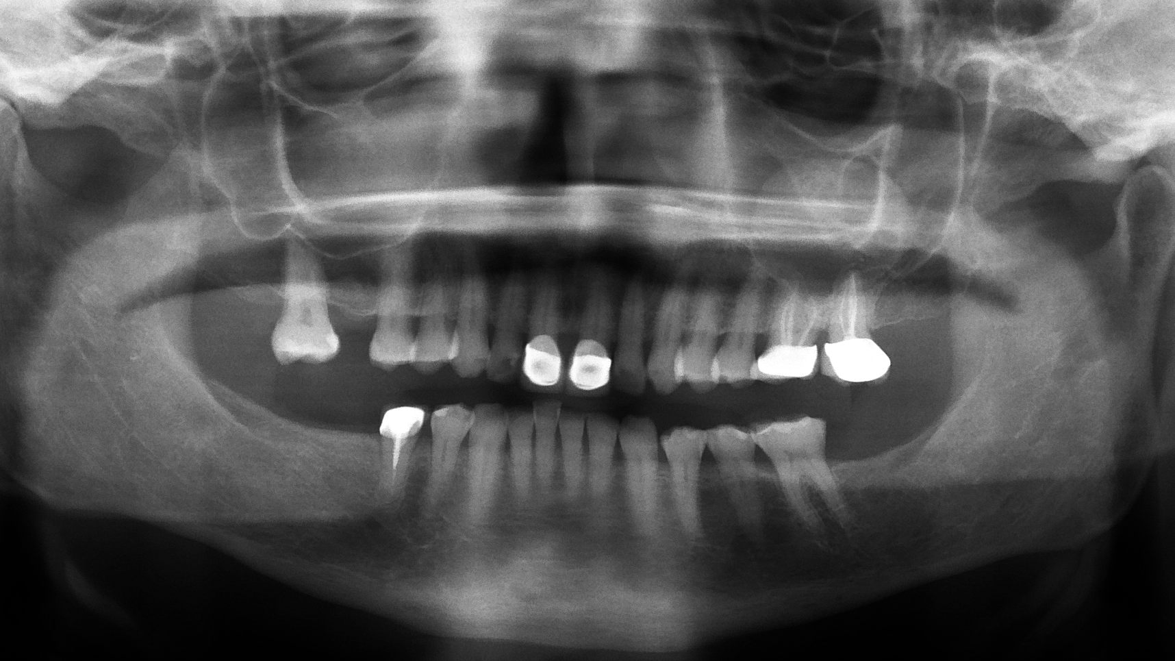 1911 Rd Hbur 16x9 5deacd279a5f3