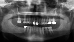 1911 Rd Hbur 16x9 5deacd279a5f3 1911 Rd Hbur 16x9 5deacd279a5f3