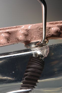 Figure 6: The Pineyro Arch Kit consists of four instruments, the Ti 1 (a), Ti 2 (b), Ti 3 (c), and Ti 4 (d). The instruments are adapted for implant maintenance (e). Figure 6: The Pineyro Arch Kit consists of four instruments, the Ti 1 (a), Ti 2 (b), Ti 3 (c), and Ti 4 (d). The instruments are adapted for implant maintenance (e).