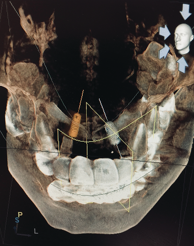 1912 Rd Hdep P01 5de9371a03247