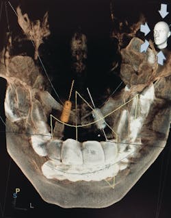 1912 Rd Hdep P01 5de9371a03247 1912 Rd Hdep P01 5de9371a03247