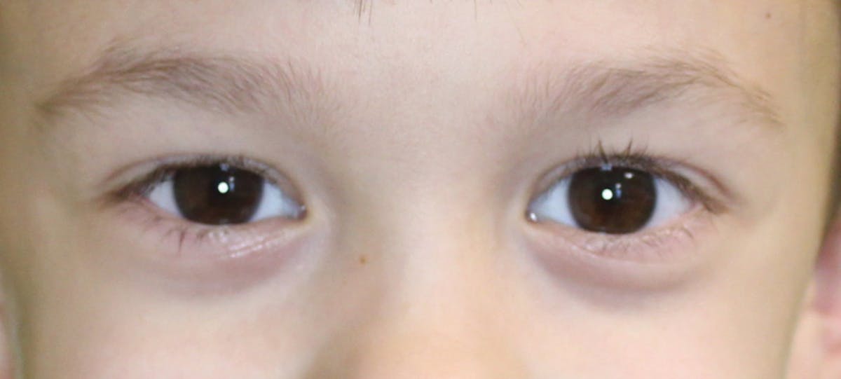 Eye spy What the eyes can tell us about the mouth Registered Dental