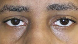 1912 Rd Hleh Thumb 5e0e14b9d73b7 1912 Rd Hleh Thumb 5e0e14b9d73b7