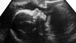 Dreamstime M 142004758 5e4ec8358a58e Dreamstime M 142004758 5e4ec8358a58e