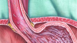 Dreamstime M 60391682 5e5fd63b21952 Dreamstime M 60391682 5e5fd63b21952