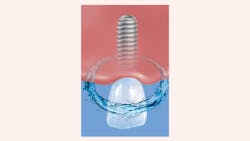 2003 Rd Hwin Thumb 5e6907e56a13e 2003 Rd Hwin Thumb 5e6907e56a13e