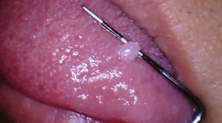 2004 Rd Hbur P01