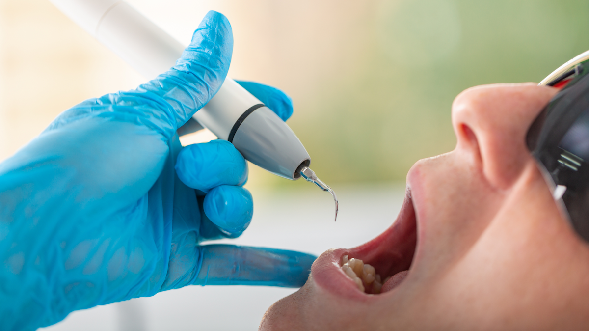 New Rdh Survey Hygienists Are Questioning The Use Of Ultrasonic Instruments During The Pandemic Registered Dental Hygienist Rdh Magazine