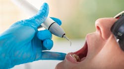 Dreamstime M 154117814 5ebd78c430b28 Dreamstime M 154117814 5ebd78c430b28