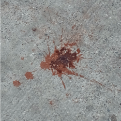 Figure 2: Betel quid liquid on roads and walkways in India Figure 2: Betel quid liquid on roads and walkways in India