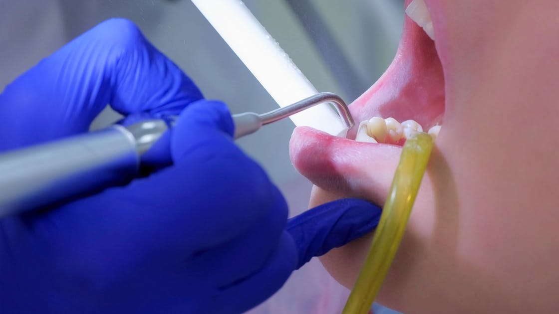 Infection Prevention & Control in Dental Settings