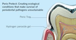 Figure 2: Graphic representation of the Perio Protect method Figure 2: Graphic representation of the Perio Protect method