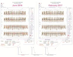 Figure 1: Florida Probe’s printout of exam results provides key metrics in determining periodontal stability. Figure 1: Florida Probe’s printout of exam results provides key metrics in determining periodontal stability.