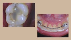 Mouthwatch Metro Sanchez 5fdb8b36be4cb Mouthwatch Metro Sanchez 5fdb8b36be4cb