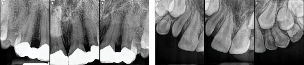 Figure 2: Depicts the image of a mother and daughter both missing teeth nos. 7 and 10. Both have a form of EDS.
