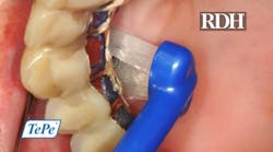 1055402353 640 602156d9a1c8c 1055402353 640 602156d9a1c8c