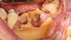 2104 Rd Hlip P01 602aa4d7b1144 2104 Rd Hlip P01 602aa4d7b1144