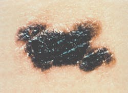 Figure 2: B = Border Figure 2: B = Border