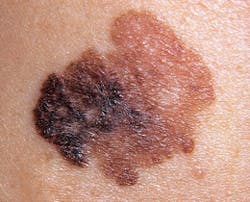 Figure 4: D = Diameter Figure 4: D = Diameter