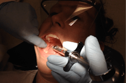 Figure 1: Ideal positioning for a right IANB. Note the clinician’s index finger bisecting the height of the coronoid notch and barrel positioning on the contralateral labial commissure and approximation 1 mm lateral to the pterygomandibular raphe. Figure 1: Ideal positioning for a right IANB. Note the clinician’s index finger bisecting the height of the coronoid notch and barrel positioning on the contralateral labial commissure and approximation 1 mm lateral to the pterygomandibular raphe.