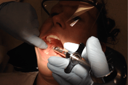 Figure 1: Ideal positioning for a right IANB. Note the clinician’s index finger bisecting the height of the coronoid notch and barrel positioning on the contralateral labial commissure and approximation 1 mm lateral to the pterygomandibular raphe. Figure 1: Ideal positioning for a right IANB. Note the clinician’s index finger bisecting the height of the coronoid notch and barrel positioning on the contralateral labial commissure and approximation 1 mm lateral to the pterygomandibular raphe.