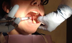 Figure 2: Ideal positioning for a left IANB. Note the clinician’s thumb bisecting the height of the coronoid notch and barrel positioning on the contralateral labial commissure and approximation 1 mm lateral to the pterygomandibular raphe. Figure 2: Ideal positioning for a left IANB. Note the clinician’s thumb bisecting the height of the coronoid notch and barrel positioning on the contralateral labial commissure and approximation 1 mm lateral to the pterygomandibular raphe.