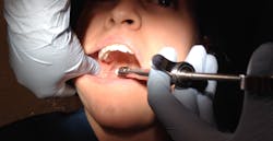 Figure 4: The same patient as noted in Figure 3; however, the coronoid notch is unilaterally skewed and significantly lower as demonstrated in the right mandibular block noted. Figure 4: The same patient as noted in Figure 3; however, the coronoid notch is unilaterally skewed and significantly lower as demonstrated in the right mandibular block noted.