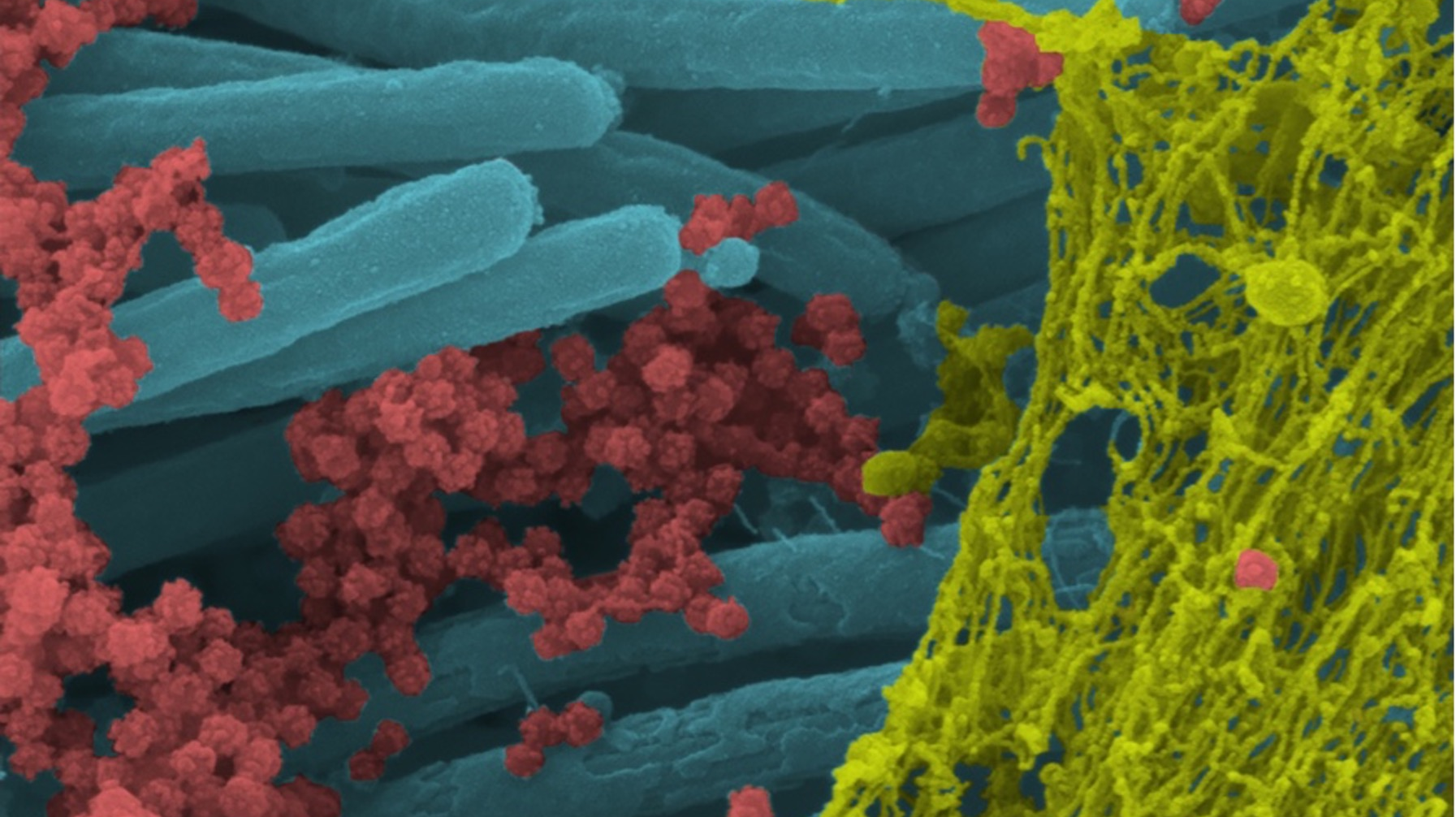 Figure 1: SARS-CoV-2 viruses (red) dispersed among the cilia (blue) and protected by the mucous (yellow), which interferes with the kill potential of antiseptic rinses.